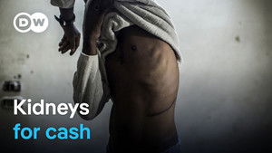 The global organ trafficking network